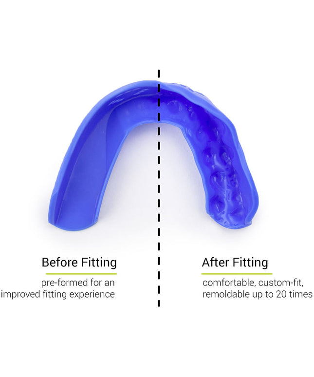 SISU 3D Custom Fit Mouth Guard