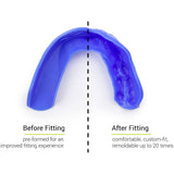 SISU 3D Custom Fit Mouth Guard